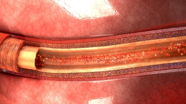 口腔癌能活多久