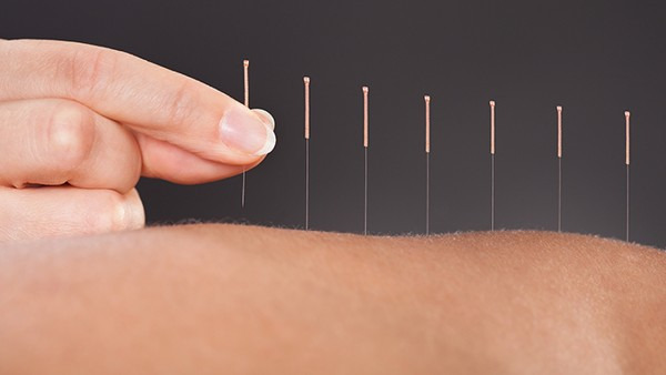 针灸能治好脾虚吗
