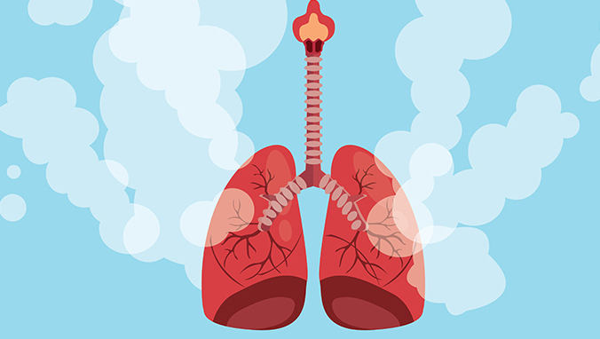 胸椎神经源性肿瘤能治吗