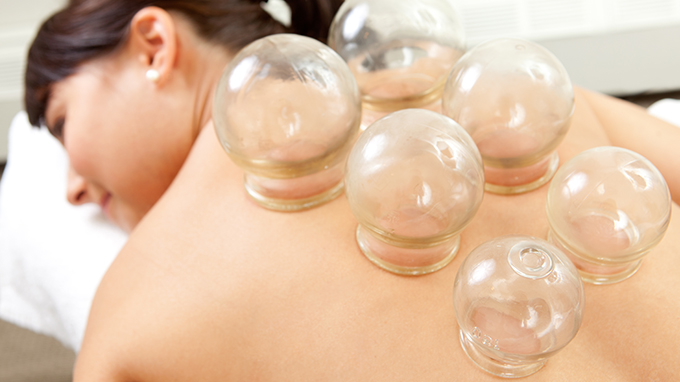 哪些人不适合拔罐呢