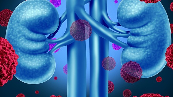 口腔癌放疗后如何护理