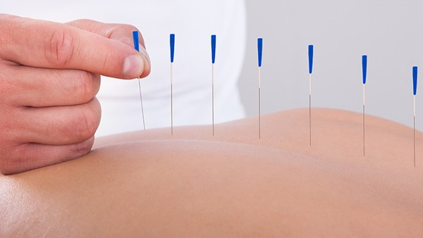 针灸后多久可以汗蒸