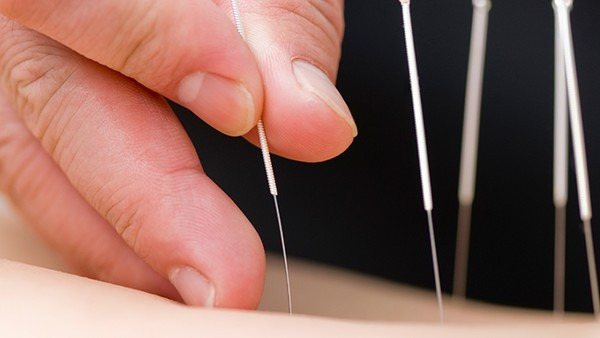 针灸为什么不出血