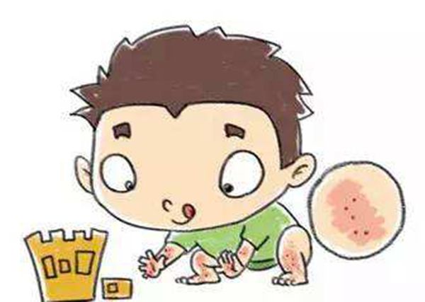 麻疹的起因和治疗,治疗小儿麻疹的食疗偏方