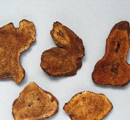 过敏性结肠炎的中医治疗医案