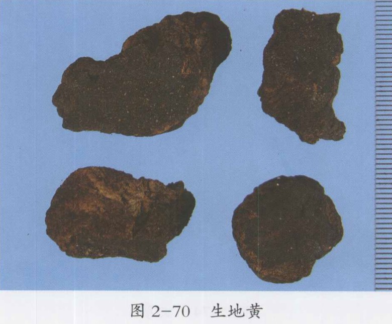 龙胆泻肝汤加减治疗三叉神经痛