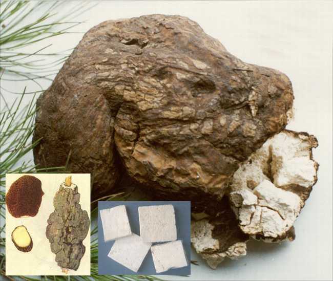 苏子降气汤加减治疗支气管炎久咳伤肺