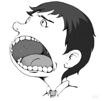 口腔溃疡是什么原因？口腔溃疡反复发作怎么办？口腔溃疡的治疗方法