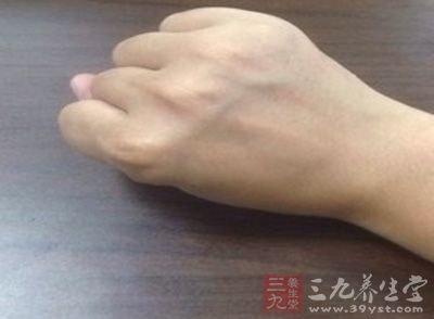 身体各部位青筋明显的原因