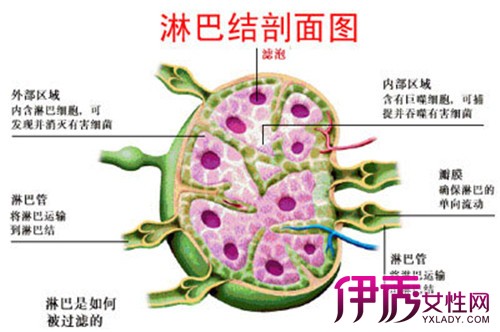 哪些疾病最容易引起淋巴结肿大,哪些淋巴结肿大最危险