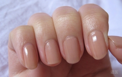 指甲看健康图解，健康的指甲是什么样的
