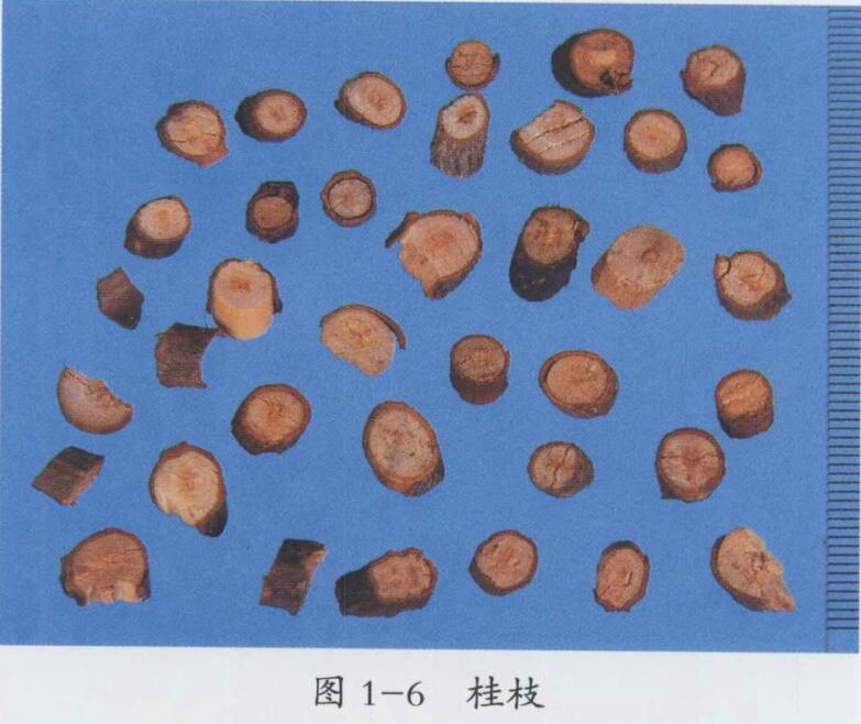 慢性肾炎尿毒症的中医治疗医案一则