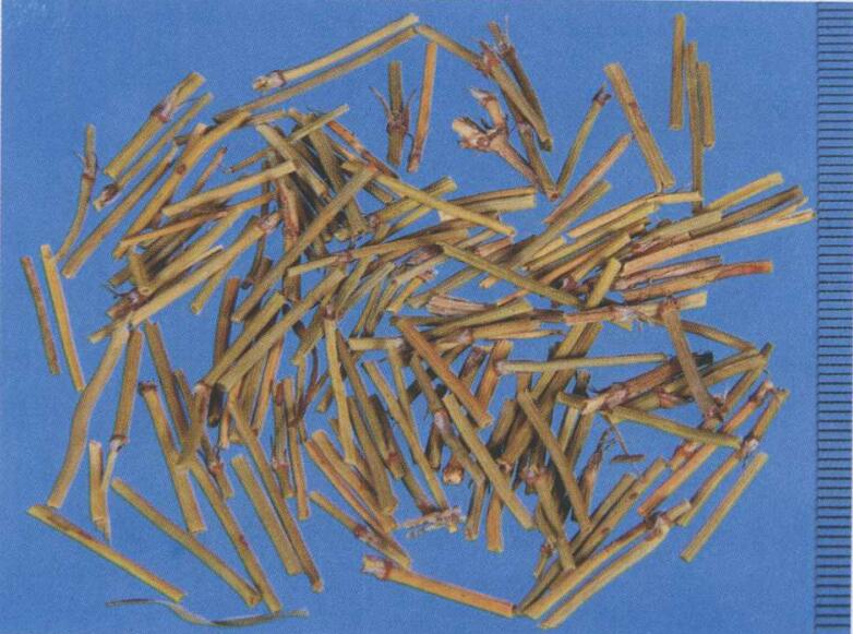 癔病性失音的中医治疗医案